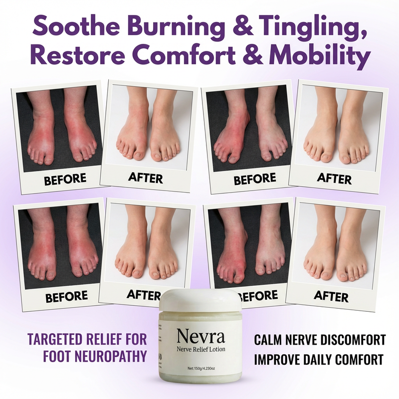 Nevra Nerve Relief Lotion